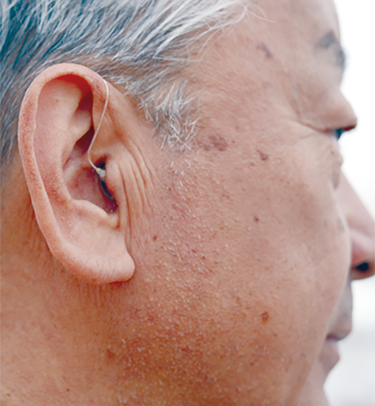 補聴器購入助成事業
